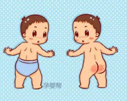 夏天穿紙尿褲真的會(huì)紅屁股嗎？