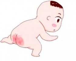 春天穿紙尿褲容易出現(xiàn)紅屁屁，4招教你輕松搞定！